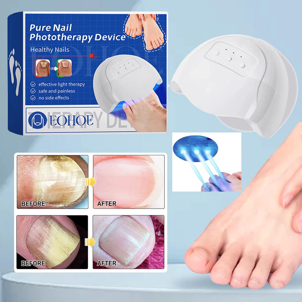 Fungal Nail Fast Repair Care Laser Device Nails Fungus Anti Infection ...