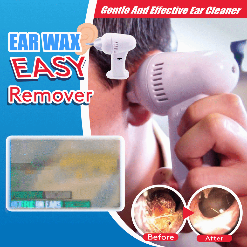 Electric Safety Ear Wax Easy Remover